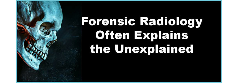 The Crucial Role of Forensic Radiology: Unveiling Truth Through Imaging