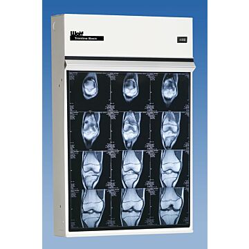 Trimline Single Bank X-Ray Illuminator