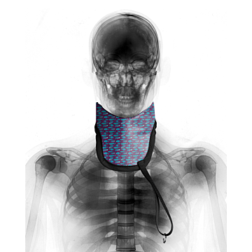 Classic Thyroid Collar - TSC