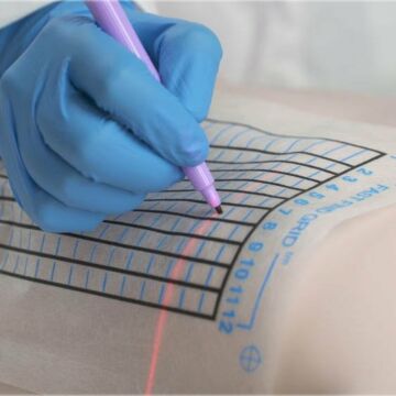 Fast Find Grid for CT Biopsies