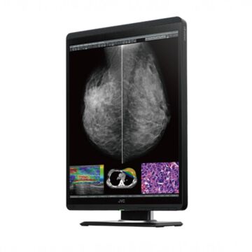 JVC 5MP 21.3" Color Mammography Diagnostic Display Monitor - CL-S500