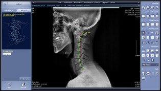 Chiropractic Digital X-Ray